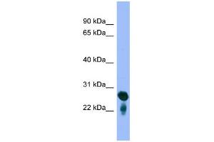 WB Suggested Anti-RAB5C Antibody Titration: 0. (Rab5c antibody  (Middle Region))