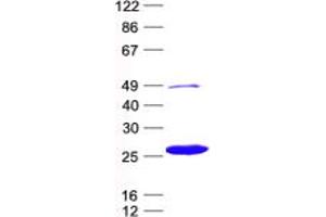 Validation with Western Blot (ITGB1BP1 Protein (His tag))