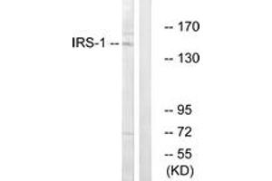 Western blot analysis of extracts from NIH-3T3 cells, using IRS-1 (Ab-312) Antibody.