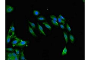 Immunofluorescent analysis of Hela cells using ABIN7171209 at dilution of 1:100 and Alexa Fluor 488-congugated AffiniPure Goat Anti-Rabbit IgG(H+L) (SNCAIP antibody  (AA 309-553))
