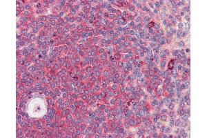 BACH2 antibody  (C-Term)