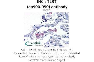 Image no. 2 for anti-Toll-Like Receptor 7 (TLR7) (AA 900-950) antibody (ABIN1740124) (TLR7 antibody  (AA 900-950))