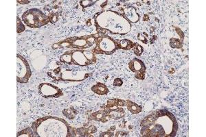 Immunohistochemistry (IHC) image for anti-Keratin 8 (KRT8) (C-Term) antibody (ABIN870546) (KRT8 antibody  (C-Term))