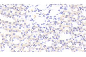 Detection of MIg in Rat Kidney Tissue using Polyclonal Antibody to Monokine Induced By Interferon Gamma (MIg) (CXCL9 antibody  (AA 22-125))