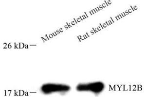 Western blot analysis of TWF2 (ABIN7076085),at dilution of 1: 1000 (TWF2 antibody)