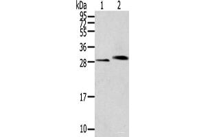 Western blot analysis of Human normal kidney tissue Human liver tissue using CLIC4 Polyclonal Antibody at dilution of 1:200 (CLIC4 antibody)
