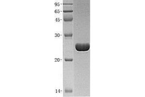 Validation with Western Blot (UCHL3 Protein (His tag))