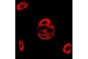 Immunofluorescent analysis of Fis1 staining in MCF7 cells. (Fission 1 antibody)
