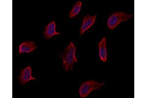 ABIN6262960 and ABIN6273263 staining Hela by IF/ICC.