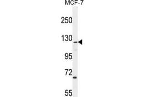 Western Blotting (WB) image for anti-CASK Interacting Protein 2 (CASKIN2) antibody (ABIN2995935)