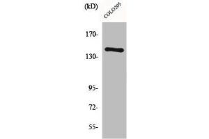 Western Blot analysis of COLO205 cells using COL2A1 Polyclonal Antibody