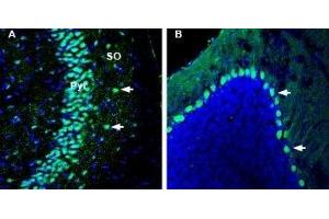 Expression of Kidins220 in mouse hippocampus and cerebellum - Immunohistochemical staining of perfusion-fixed frozen mouse brain sections with Anti-Kidins220 Antibody (ABIN7043293, ABIN7045160 and ABIN7045161), (1:1000), followed by goat-anti-rabbit-AlexaFluor-488. (KIDINS220 antibody  (Intracellular))