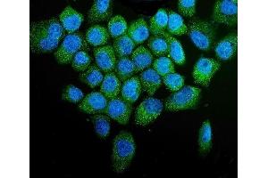 IF analysis of PINK1 using anti-PINK1 antibody (ABIN7599749). (PINK1 antibody  (AA 112-570))