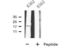 Western blot analysis of MRPL23 using K562 whole cell lysates (MRPL23 antibody  (Internal Region))