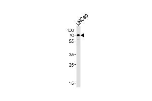 Western blot analysis of lysate from LNCap cell line, using CYP51A1 Antibody at 1:1000 at each lane.