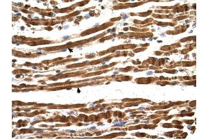 NARG1L antibody was used for immunohistochemistry at a concentration of 4-8 ug/ml to stain Skeletal muscle cells (arrows) in Human Muscle. (NARG1L antibody  (Middle Region))