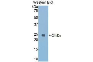 Western Blotting (WB) image for anti-Caspase 1 (CASP1) (AA 119-296) antibody (ABIN3206383) (Caspase 1 antibody  (AA 119-296))