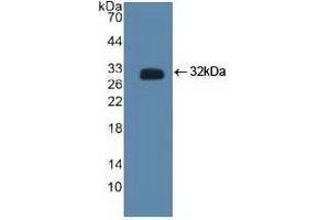 Detection of Recombinant CTBP2, Human using Polyclonal Antibody to C-Terminal Binding Protein 2 (CTBP2) (CTBP2 antibody  (AA 1-252))
