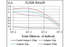 Black line: Control Antigen (100 ng), Purple line: Antigen(10 ng), Blue line: Antigen (50 ng), Red line: Antigen (100 ng), (FOXO1 antibody)