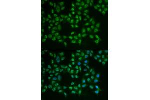 Immunofluorescence (IF) image for anti-Bruton Agammaglobulinemia tyrosine Kinase (BTK) (AA 30-240) antibody (ABIN3022171) (BTK antibody  (AA 30-240))