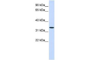 WNT6 antibody used at 1 ug/ml to detect target protein. (WNT6 antibody  (Middle Region))