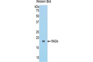 Western blot analysis of the recombinant protein. (MGEA5 antibody  (AA 83-222))