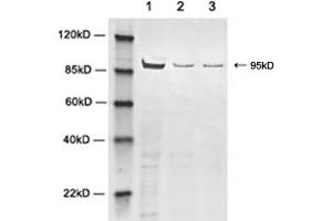 Western blot analysis of cell lysates using 2 µg/mL Rabbit Anti-PKCµ Polyclonal Antibody (ABIN398590) Lane 1: Hela cell lysateLane 2: HEK-293 cell lysateLane 3: NIH/3T3 cell lysateThe signal was developed with IRDyeTM 800 Conjugated Goat Anti-Rabbit IgG. (PKCmy antibody)