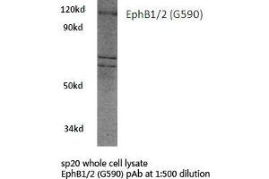 Western blot (WB) analysis of EphB1/2 antibody in extracts from sp20 cells.