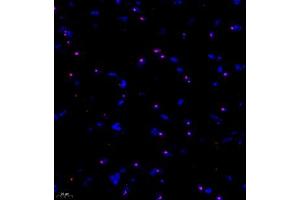 Immunofluorescent analysis of paraffin embedded mouse brain using KCNIP3 (ABIN7073771) at dilution of 1: 1000 (DREAM antibody)