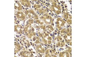 Immunohistochemistry of paraffin-embedded human gastric using HSPE1 antibody (ABIN5975532) at dilution of 1/100 (40x lens).