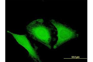 Immunofluorescence of purified MaxPab antibody to OPTN on HeLa cell. (OPTN antibody  (AA 1-577))