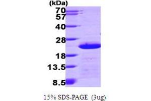 CETN2 Protein (AA 1-172) (His tag)