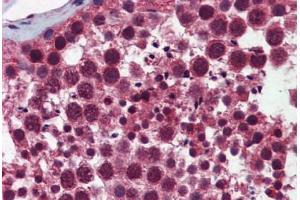 Human Testis: Formalin-Fixed, Paraffin-Embedded (FFPE) (Selenoprotein S antibody  (AA 72-121))