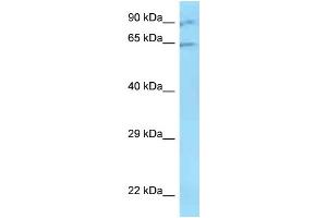 WB Suggested Anti-ZNF280B Antibody   Titration: 1. (ZNF280B antibody  (N-Term))