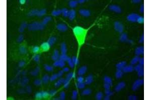 Shows rat mixed neuron/glial cultures stained with UCHL1 polyclonal antibody  (green). (UCHL1 antibody)