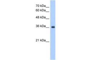 Western Blotting (WB) image for anti-ELOVL Fatty Acid Elongase 7 (ELOVL7) antibody (ABIN2463300) (ELOVL7 antibody)