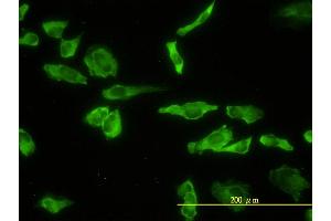 Immunofluorescence of monoclonal antibody to ACP2 on HeLa cell. (ACP2 antibody  (AA 1-423))