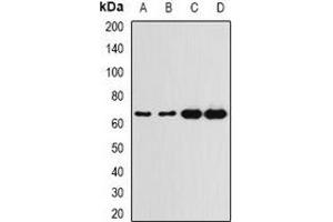 Western blot analysis of G6PD expression in A549 (A), HT29 (B), K562 (C), mouse spleen (D) whole cell lysates. (Glucose-6-Phosphate Dehydrogenase antibody)