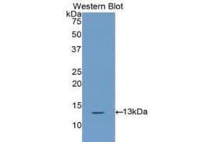 Western Blotting (WB) image for anti-Cystatin A (Stefin A) (CSTA) (AA 1-98) antibody (ABIN1172941) (CSTA antibody  (AA 1-98))