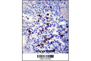 TNN Antibody immunohistochemistry analysis in formalin fixed and paraffin embedded human uterus tissue followed by peroxidase conjugation of the secondary antibody and DAB staining. (Tenascin N antibody  (AA 587-615))