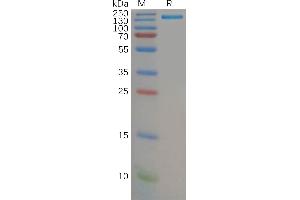 SDS-PAGE (SDS) image for Complement Component (3d/Epstein Barr Virus) Receptor 2 (CR2) (AA 21-971) protein (Fc Tag) (ABIN6964133)