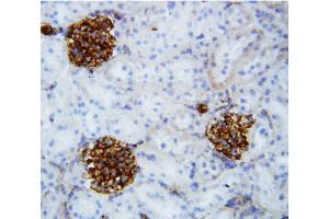 Anti-Collagen IV antibody, IHC(F) IHC(F): Rat Kidney Tissue (COL4a2 antibody  (C-Term))