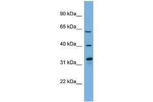 WB Suggested Anti-FMO3  Antibody Titration: 0. (FMO3 antibody  (N-Term))