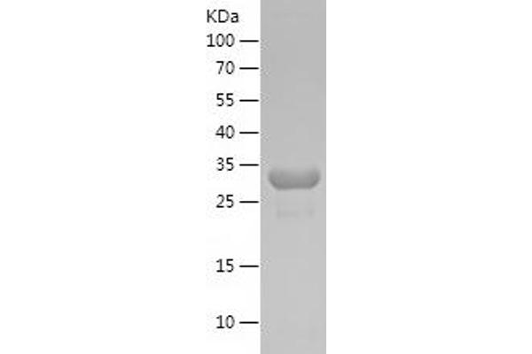 PGAM1 Protein (AA 79-154) (His-IF2DI Tag)