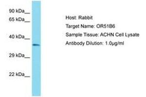 OR51B6 Antikörper  (AA 200-249)