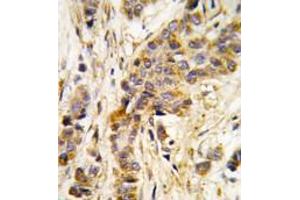 Image no. 1 for anti-Isoleucyl-tRNA Synthetase 2, Mitochondrial (IARS2) (Middle Region) antibody (ABIN360191) (IARS2 antibody  (Middle Region))