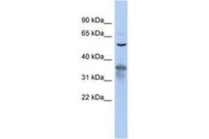 Image no. 1 for anti-RAB3A Interacting Protein (Rabin3) (RAB3IP) (AA 35-84) antibody (ABIN6743738)