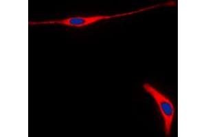 Immunofluorescent analysis of RET staining in HeLa cells. (Ret Proto-Oncogene antibody  (C-Term))