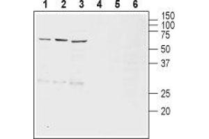 Western blot analysis of rat brain (lanes 1 and 4), mouse brain (lanes 2 and 5) and rat brain stem (lanes 3 and 6) lysates: - 1-3. (SLC18A2 antibody  (1st Lumenal Region))