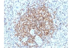 ABIN6383843 to BCL2 was successfully used to stain cells primarily in the germinal centre of human spleen sections. (Recombinant Bcl-2 antibody)